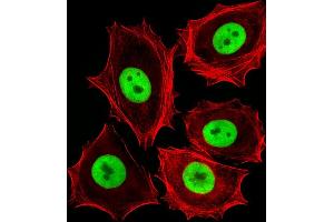 Fluorescent image of MCF-7 cells stained with (Rat) Cdk4 Antibody (C-term) B. (CDK4 antibody  (C-Term))