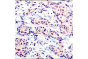 Image no. 2 for anti-Jun D Proto-Oncogene (JUND) (Ser255) antibody (ABIN197142) (JunD antibody  (Ser255))