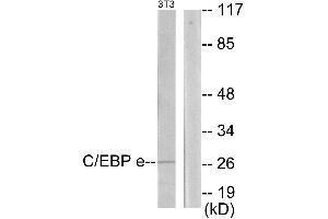 Western blot analysis of extracts from NIH-3T3 cells, using CEBPE antibody. (CEBPE antibody)