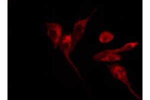 ABIN6269091 staining HepG2 by IF/ICC. (Integrin beta 3 antibody  (C-Term))
