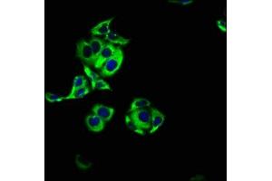 Immunofluorescence staining of PC-3 cells with ABIN7143505 at 1:100, counter-stained with DAPI. (ARL4C antibody  (AA 2-192))