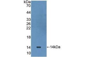 Western blot analysis of recombinant Human IL10Ra. (IL-10RA antibody  (AA 132-235))