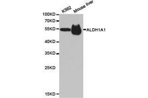 Western Blotting (WB) image for anti-Aldehyde Dehydrogenase 1 Family, Member A1 (ALDH1A1) antibody (ABIN1870918) (ALDH1A1 antibody)