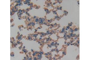 IHC-P analysis of Kidney tissue, with DAB staining. (TNFRSF19 antibody  (AA 61-163))