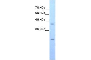 Western Blotting (WB) image for anti-FLJ20489 antibody (ABIN2462594) (FLJ20489 antibody)