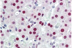 Human Adrenal (formalin-fixed, paraffin-embedded) stained with DDB1 antibody ABIN396934 at 5 ug/ml followed by biotinylated anti-mouse IgG secondary antibody ABIN481714, alkaline phosphatase-streptavidin and chromogen. (DDB1 antibody)