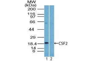 Image no. 1 for anti-Colony Stimulating Factor 2 (Granulocyte-Macrophage) (CSF2) (AA 1-50) antibody (ABIN960118) (GM-CSF antibody  (AA 1-50))