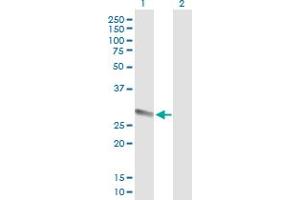 Western Blot analysis of PRSS1 expression in transfected 293T cell line by PRSS1 MaxPab polyclonal antibody. (PRSS1 antibody  (AA 1-247))