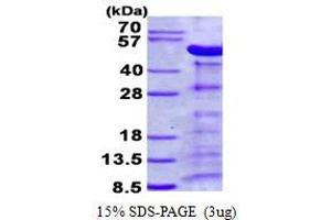 Image no. 1 for Parvin, alpha (PARVA) protein (His tag) (ABIN1098425) (Parvin alpha Protein (His tag))