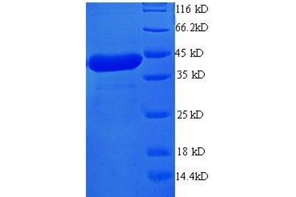 PDCD6 Protein (AA 1-191, full length) (GST tag)