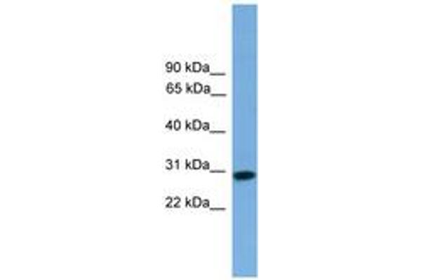 RCAN2 antibody  (AA 71-120)