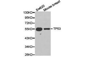 Western Blotting (WB) image for anti-Tumor Protein P53 (TP53) antibody (ABIN1875168) (p53 antibody)