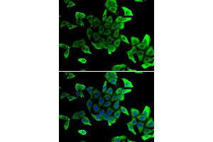 Immunofluorescence analysis of U20S cell using SGCD antibody. (SGCD antibody)