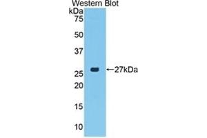 Detection of Recombinant CTGF, Porcine using Polyclonal Antibody to Connective Tissue Growth Factor (CTGF) (CTGF antibody  (AA 101-330))