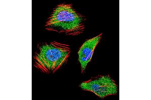 Fluorescent confocal ige of Hela cell stained with SD4 Antibody (C-term) (ABIN652388 and ABIN2841883). (SMAD4 antibody  (C-Term))