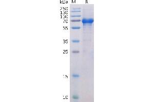 Human OX40 Protein, hFc-His Tag on SDS-PAGE under reducing condition. (TNFRSF4 Protein (AA 29-216) (Fc-His Tag))