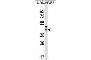 Western blot analysis in MDA-MB453 cell line lysates (35ug/lane). (PPT2 antibody  (AA 183-212))