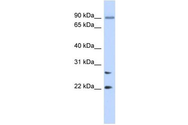 JOSD2 antibody  (N-Term)