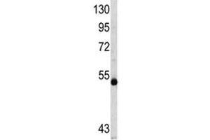 Western blot analysis of MYCN antibody and CEM lysate (MYCN antibody  (AA 322-351))