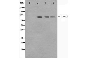 Western blot analysis on Jurkat,COS7 and HuvEc cell lysate using XRCC1 Antibody. (XRCC1 antibody)