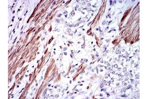 Immunohistochemistry (IHC) image for anti-Glutathione S-Transferase mu 1 (GSTM1) antibody (ABIN969180)