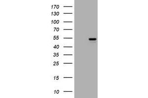 Image no. 1 for anti-Vimentin (VIM) antibody (ABIN1501717) (Vimentin antibody)