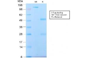 SDS-PAGE (SDS) image for anti-Spectrin, Beta, Non-erythrocytic 2 (SPTBN2) (AA 356-475) antibody (ABIN6940655)