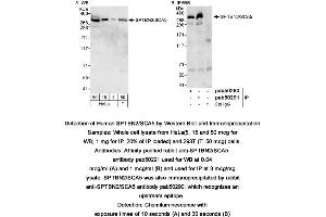 Image no. 1 for anti-Spectrin, Beta, Non-erythrocytic 2 (SPTBN2) (AA 2300-2390), (C-Term) antibody (ABIN363600) (Spectrin, Beta, Non-erythrocytic 2 (SPTBN2) (AA 2300-2390), (C-Term) antibody)