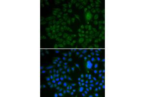 Immunofluorescence analysis of U2OS cell using LRP1 antibody. (LRP1 antibody)