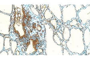 Human Thyriod: immunohistochemical staining of Thyroglobulin in the follicular epithelial cells. (Thyroglobulin antibody)