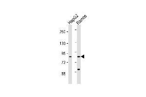 Lane 1: HepG2, Lane 2: Ramos lysate at 20 µg per lane, probed with bsm-51153M HGF (489CT6. (HGF antibody)