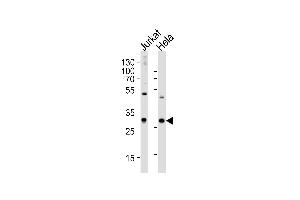 Western blot analysis of lysates from Jurkat, HeLa cell line (from left to right), using CZB Antibody (N-term) 2888a. (CAPZB antibody  (N-Term))