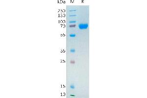Human Protein, hFc Tag on SDS-PAGE under reducing condition. (Neuregulin 1 Protein (NRG1) (AA 20-242) (Fc Tag))