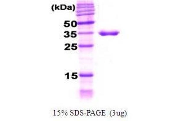 DNAJB6 Protein (AA 1-376)