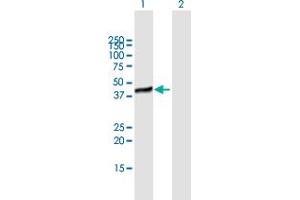 Western Blot analysis of C19orf62 expression in transfected 293T cell line by C19orf62 MaxPab polyclonal antibody. (BRISC and BRCA1 A Complex Member 1 (BABAM1) (AA 1-329) antibody)
