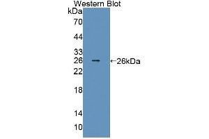 Detection of Recombinant Smad2, Human using Polyclonal Antibody to Mothers Against Decapentaplegic Homolog 2 (Smad2) (SMAD2 antibody  (AA 274-467))