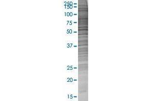 C5orf36 transfected lysate. (MGC34713 293T Cell Transient Overexpression Lysate(Denatured))