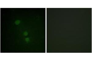 Immunofluorescence analysis of HeLa cells, using Histone H2B (Acetyl-Lys15) Antibody. (Histone H2B antibody  (acLys15))