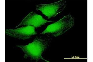 Immunofluorescence of purified MaxPab antibody to TP53 on HeLa cell. (p53 antibody  (AA 1-393))