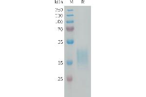 Human C Protein, His Tag on SDS-PAGE under reducing condition. (CRLF2 Protein (AA 23-231) (His tag))