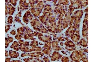 IHC image of nme1HU diluted at 1:25 and staining in paraffin-embedded human pancreatic cancer performed on a Leica BondTM system. (HIST1H4A antibody)