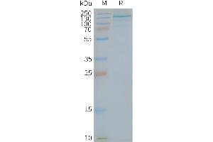 Human -Nanodisc, Flag Tag on SDS-PAGE (TLR7 Protein)