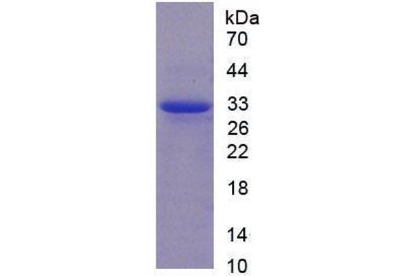 CAPNL1 Protein (AA 75-356) (His tag)