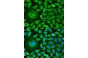 Immunofluorescence analysis of U2OS cells using UBIAD1 antibody (ABIN6293617) at dilution of 1:100. (UBIAD1 antibody)