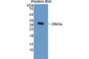 Figure. (IL17RC antibody  (AA 257-477))