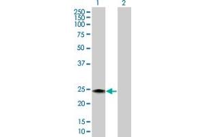 Western Blot analysis of RAB43 expression in transfected 293T cell line by RAB43 MaxPab polyclonal antibody. (RAB43 antibody  (AA 1-212))