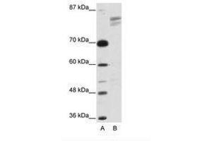 Image no. 1 for anti-General Transcription Factor III (GTF2I) (AA 208-257) antibody (ABIN203263) (GTF2I antibody  (AA 208-257))