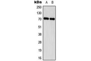 Western blot analysis of Delta-NaCH expression in HEK293A (A), MDA-MB231 (B) whole cell lysates. (delta NaCH (Center) antibody)