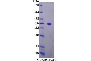 Image no. 1 for Interferon, alpha 2 (IFNA2) (AA 24-192) protein (His tag) (ABIN4988355) (IFNA2 Protein (AA 24-192) (His tag))