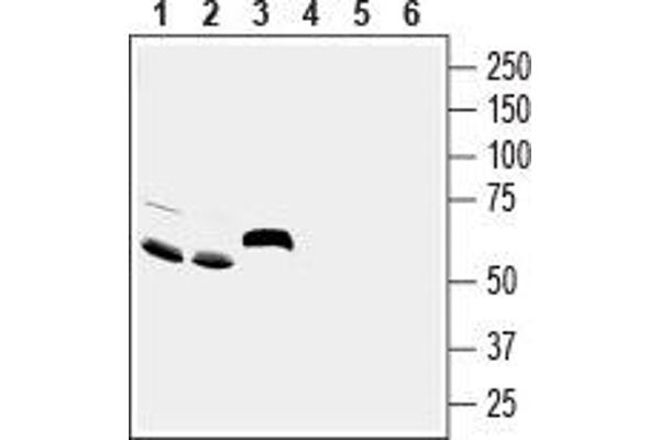 ACCN5 抗体  (Extracellular Loop)